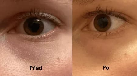 Před a po použití séra