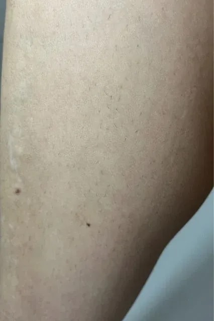 Braun IPL Skin i·expert recenze
