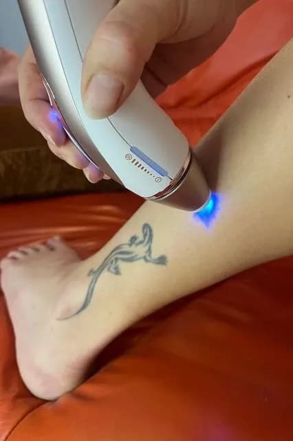 Braun IPL Skin i·expert test