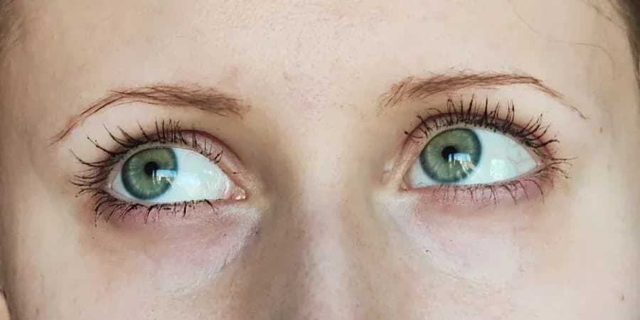 Venira sérum pro podporu růstu řas a obočí výsledek