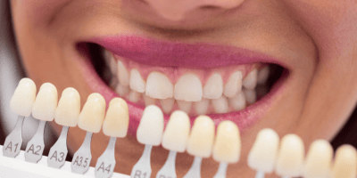 Nejlepší produkty na domácí bělení zubů: rady a tipy